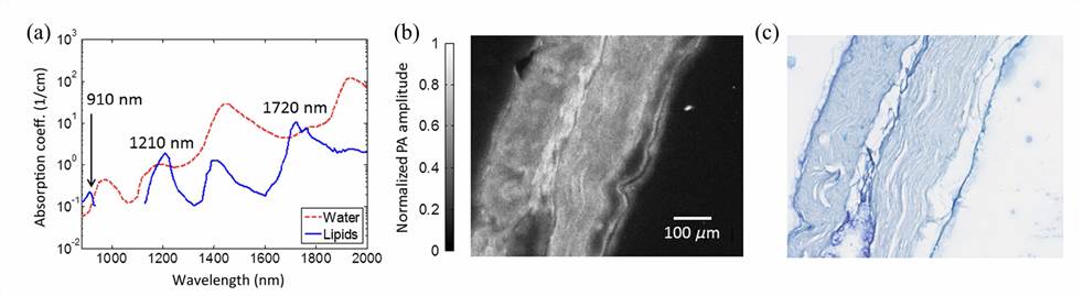 Synthetic Gene Circuits for Cancer Immunotherapy - Turning Cancer Cells Against Themselves.