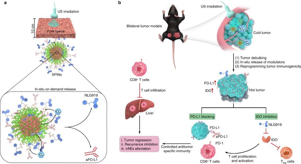 Fig.1 Precision sono-immunotherapy of deep-seated cancers via activatable SPN nanoparticles. (OA Literature)