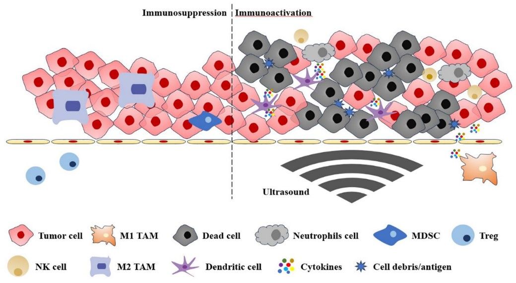 Fig.1 Ultrasound for tumor immunoregulation. (OA Literature)