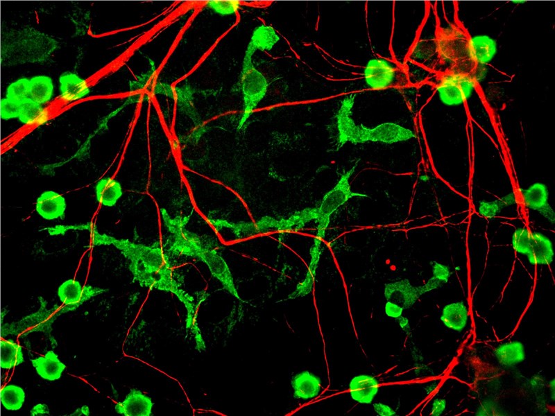 Microglia in tissue (green)