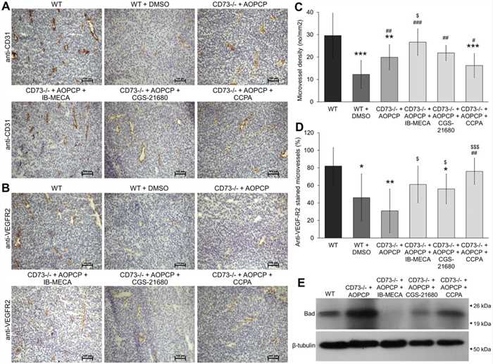 Fig.3 The A3 adenosine receptor regulates the expression of major pro-angiogenic factors in B16F10 melanoma. (Koszałka, et al., 2016)