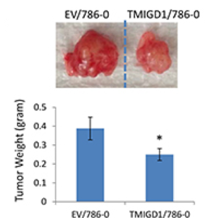 Fig.1 Re-expression of TMIGD1 inhibits renal tumor growth. (Meyer, et al., 2018)