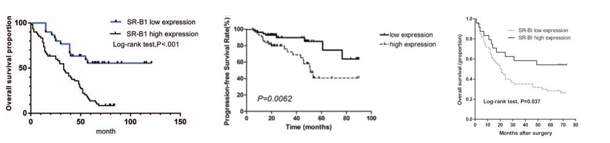 Kaplan–Meier curves of the association between SR-B1 expression and the patients’ overall survival in lung cancer (Feng, 2018): RCC (Xu, 2018): and gastric cancer (Wang, et al., 2018).