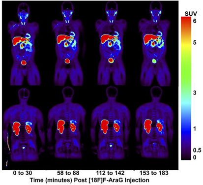 Fig.1 Whole body PET images of 18F-FAraG in a healthy human volunteer. (Ronald, 2017)