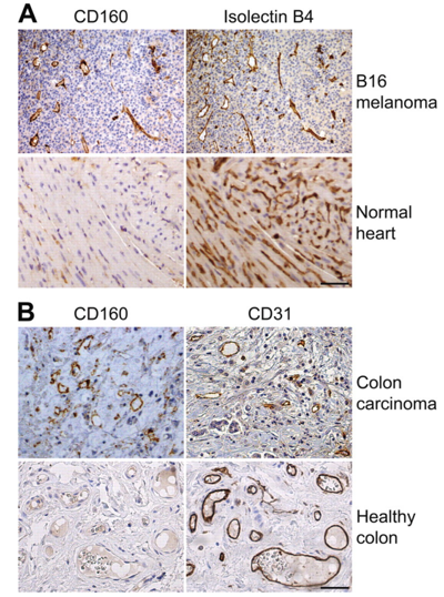 Expression of CD160 in tumor blood vessels but not in the blood vessels of healthy tissues. 