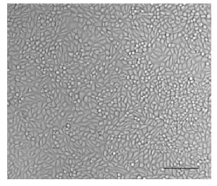 Fig.1 Breast cancer cell MDA-MB-468.