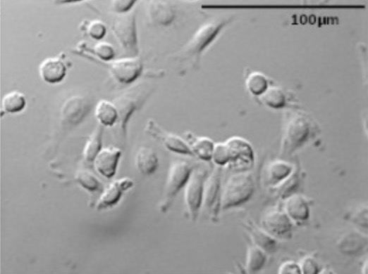 Fig.1 Immunofluorescence images of AGS cells.