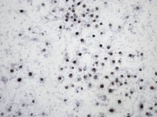 Fig.1 Images displaying the results of Ki-67 immunohistochemical staining in the BGC-823 cell line.