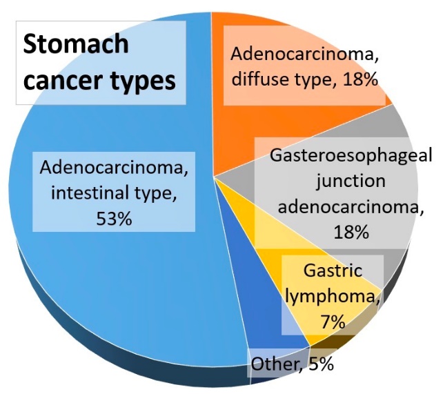 Fig.1 Stomach cancer types by relative incidence. (Wikipedia)