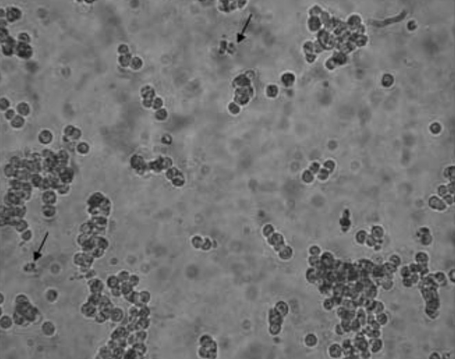 Fig.1 Morphology of MKN-45 cells.