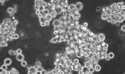 Fig.1 Culture of SNU cell lines.