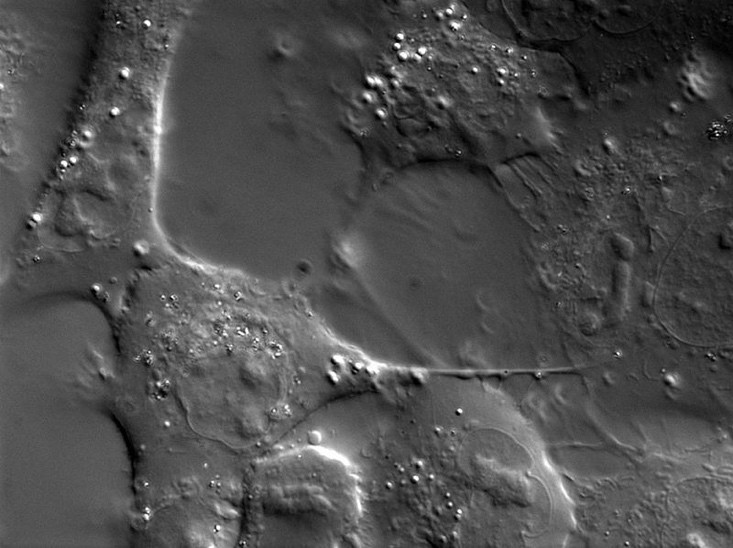 Fig.1 A549 cells under DIC microscopy.