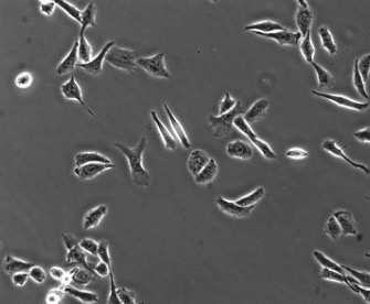 Fig.1 Microscopic images of lung cancer cell CL1-5 cancer cells.