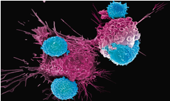 Next CAR-T Therapy Development