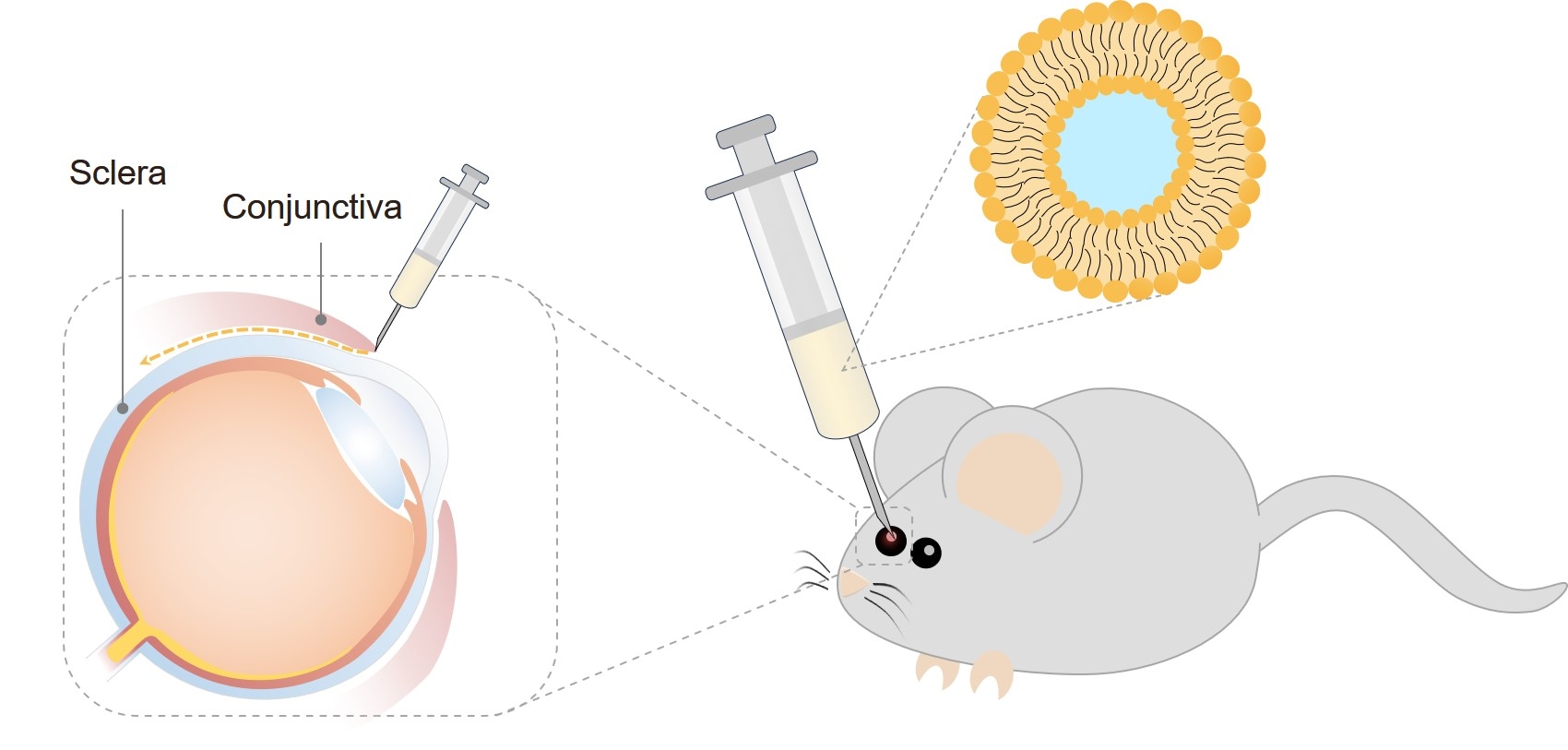 Fig.1 Subconjunctival injection. (Creative Biolabs Original)