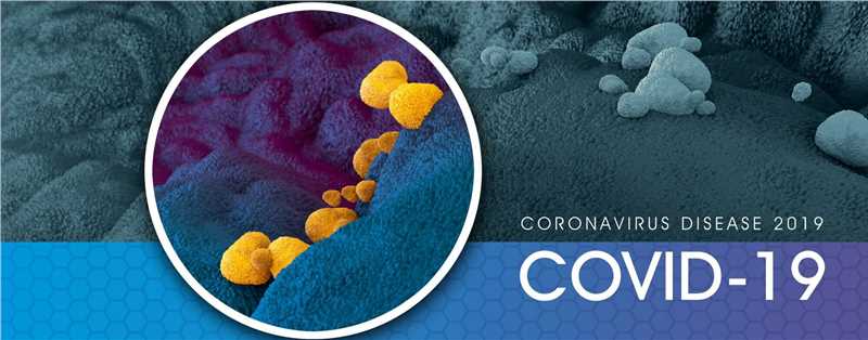 COVID-19-2. (Creative Biolabs Authorized)