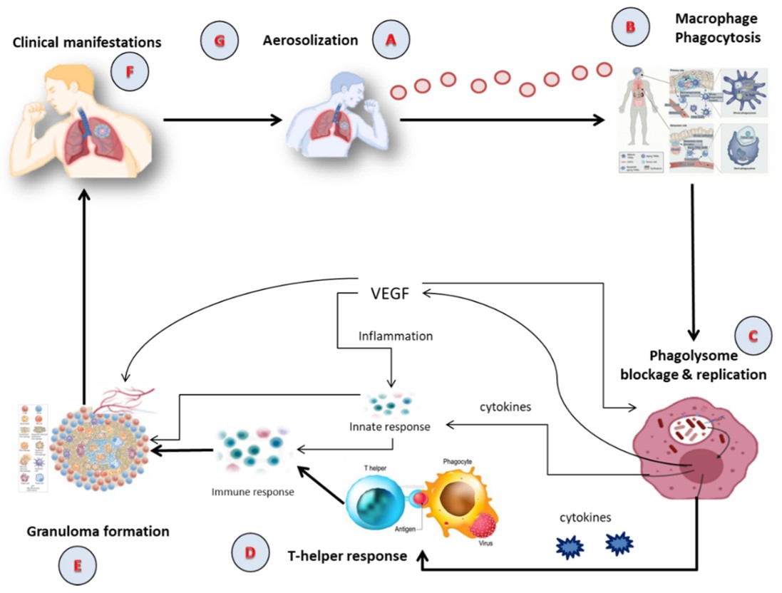 Pathophysiology of TB. (OA Literature)