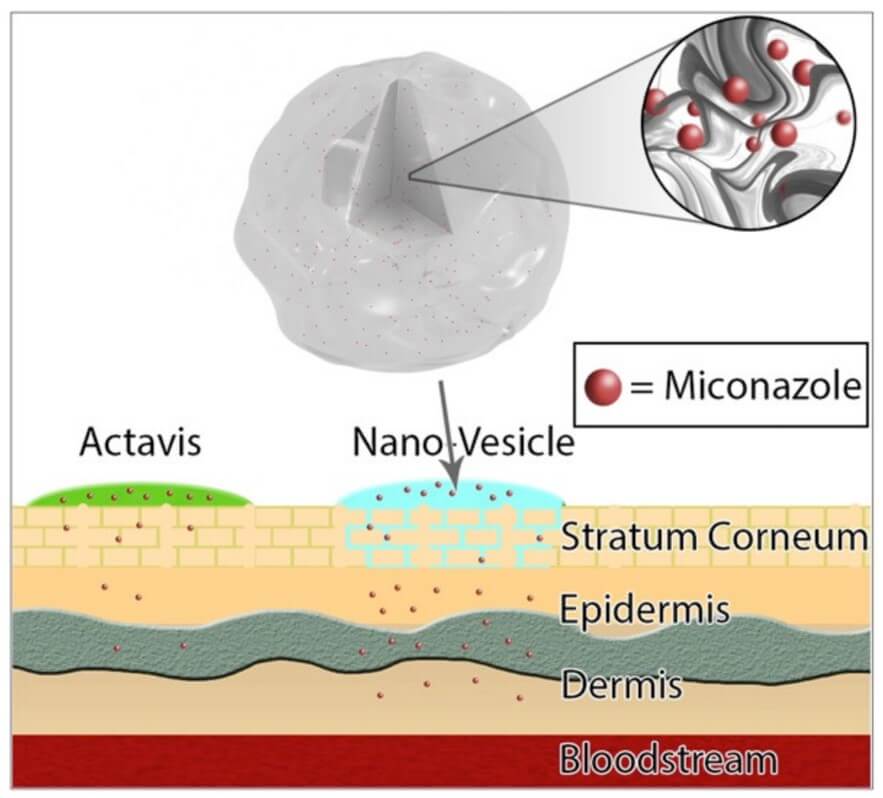 Miconazole-loaded nanoparticles. (OA Literature)