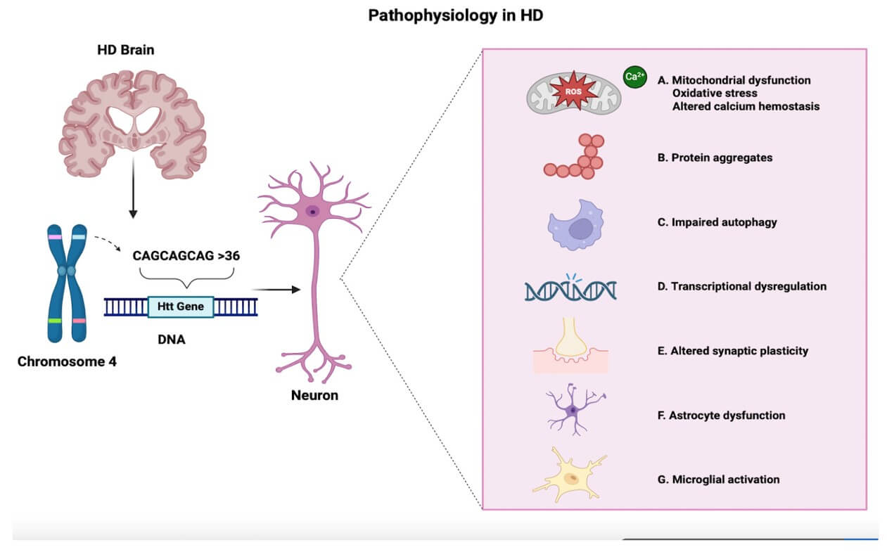 The pathophysiology of HD.(OA Literature) 