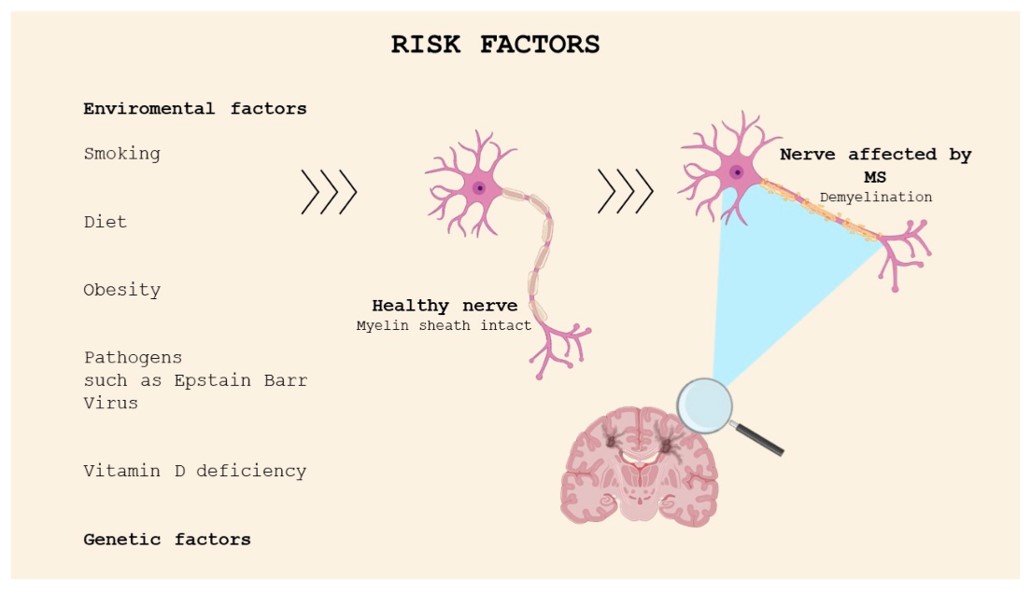 Risk factors of multiple sclerosis. (OA Literature) 