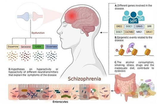 Neuroinflammation in schizophrenia. (OA Literature)