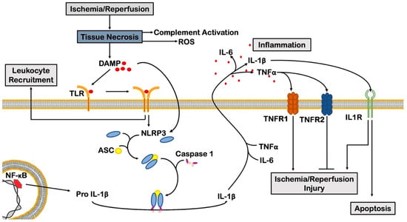 Myocardial ischemia-1 (Schirone, Leonardo, et al,2022)