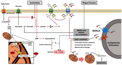 Myocardial ischemia-2 (Schirone, Leonardo, et al,2022)