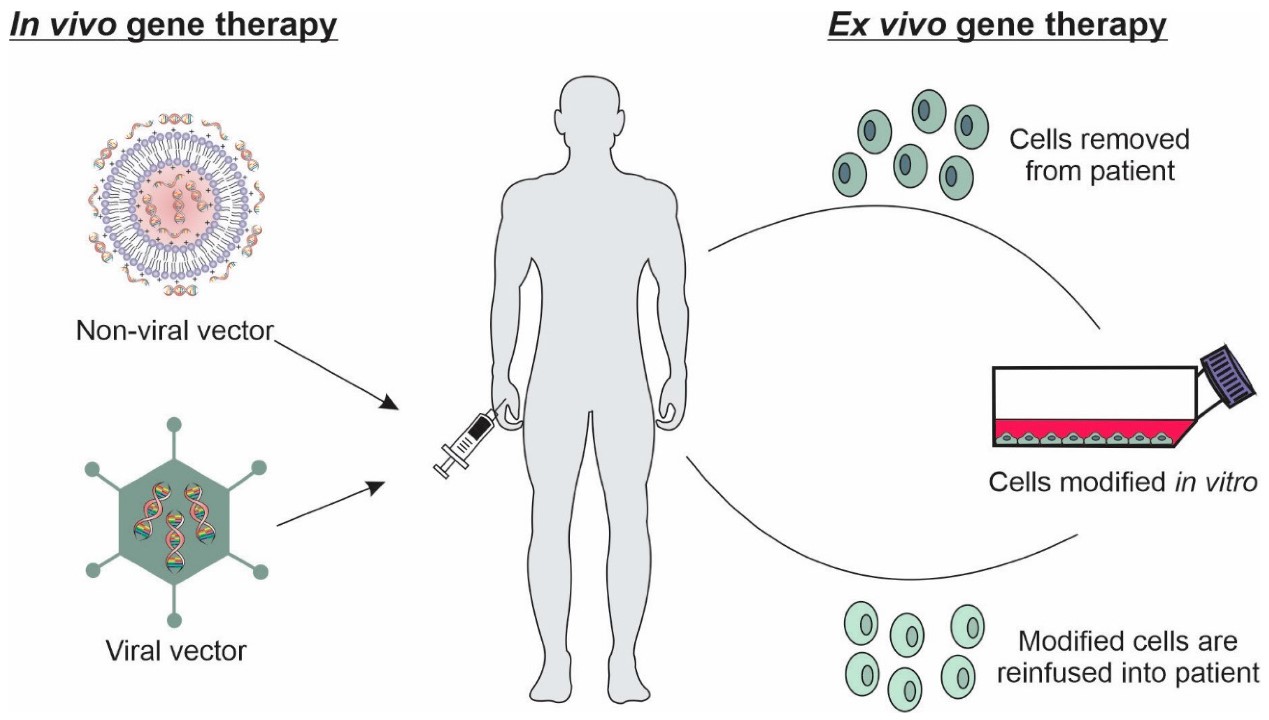 Fig.1 In Vivo and ex vivo techniques related to gene delivery to target cells. (Luiz, Marcela Tavares, et al, 2022)