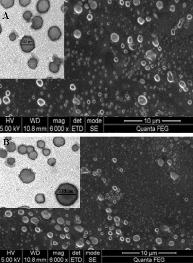 Morphological characterization of niosome. (Piri-Gharaghie, Tohid., 2022) (OA Literature)