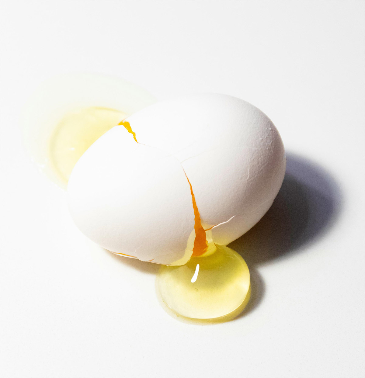 Fig.1 Egg phosphatidylcholine. (By Madison Oren, Free to use under the Unsplash License, https://unsplash.com/photos/white-egg-on-white-surface-b9id_N3uI3E )