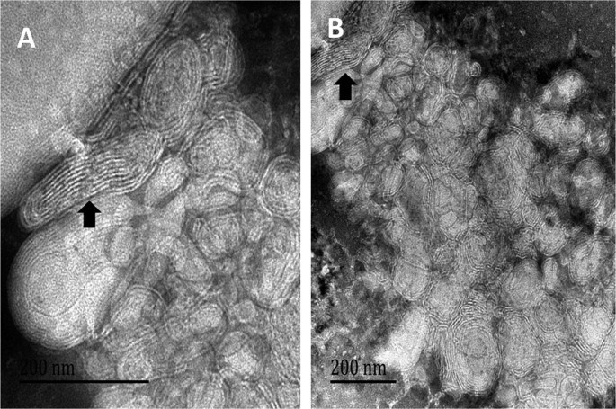 Fig.1 TEM image of nanocochleates. (Liu, Min, Xiaoming Zhong, and Zhiwen Yang, 2017)