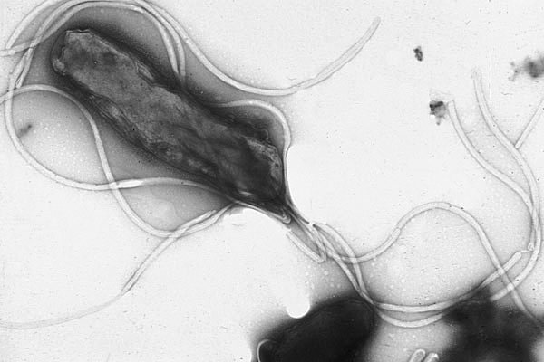 A picture of H. pylori possessing multiple flagella.