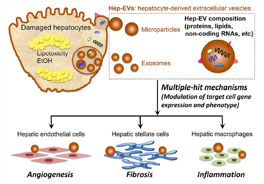 Hepatocyte-derived EVs contribute to the progression of fatty liver diseases.