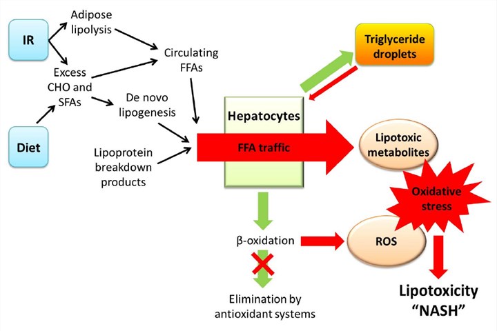 The lipotoxicity model of pathogenesis in NASH.