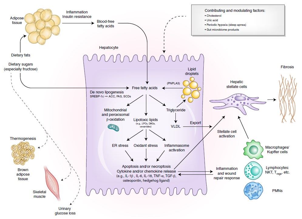 The substrate-overload liver injury model of NASH pathogenesis.