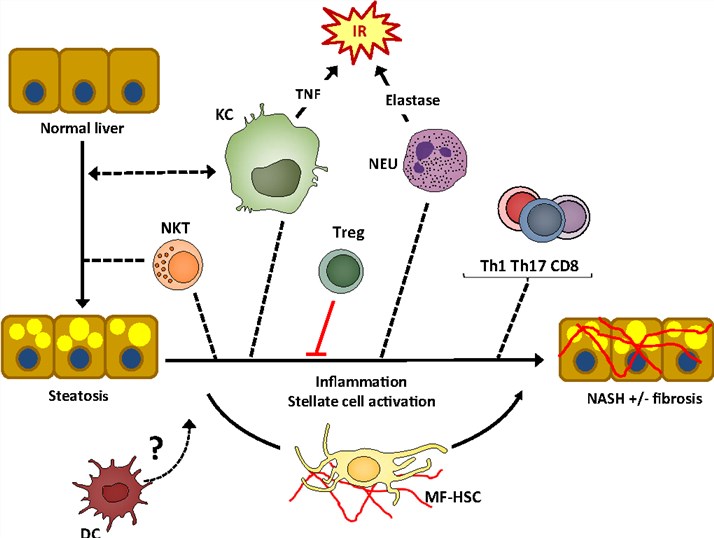 The role of immune cells in NASH development.