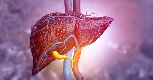 Preclinical Model Development