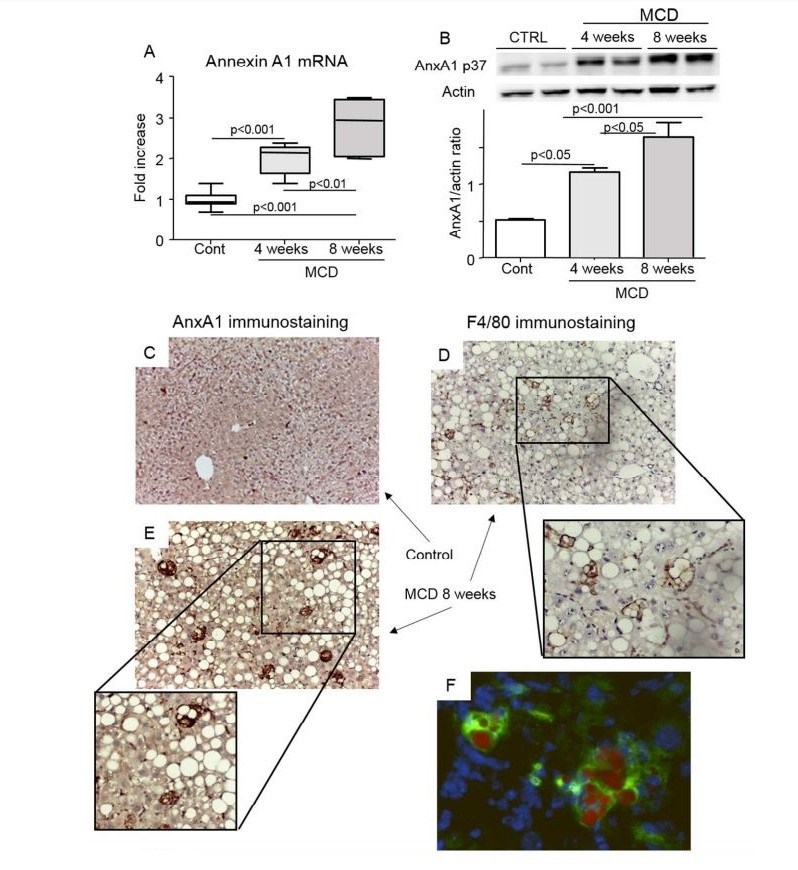 Hepatic AnxA1 expression in mice with NASH.