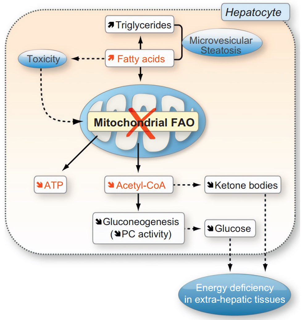 Metabolic consequences of inhibition of mitochondrial fatty acid β-oxidation.