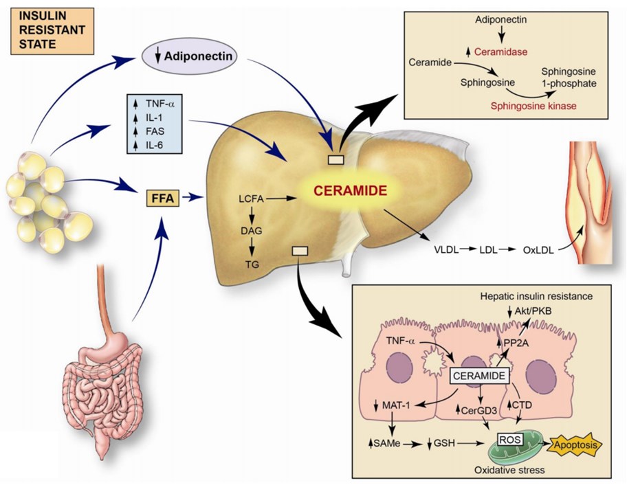 Potential role of ceramide in the development and progression of nonalcoholic fatty liver disease and related complications.