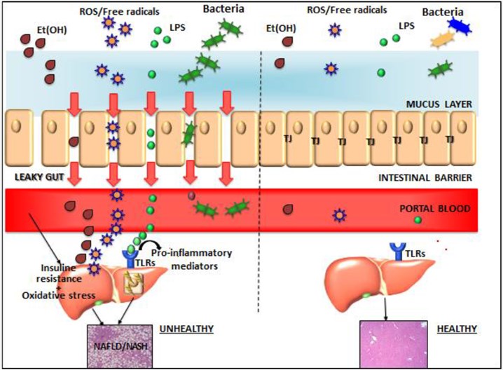 Gut-liver axis components in normal conditions and in non-alcoholic fatty liver disease (NAFLD)