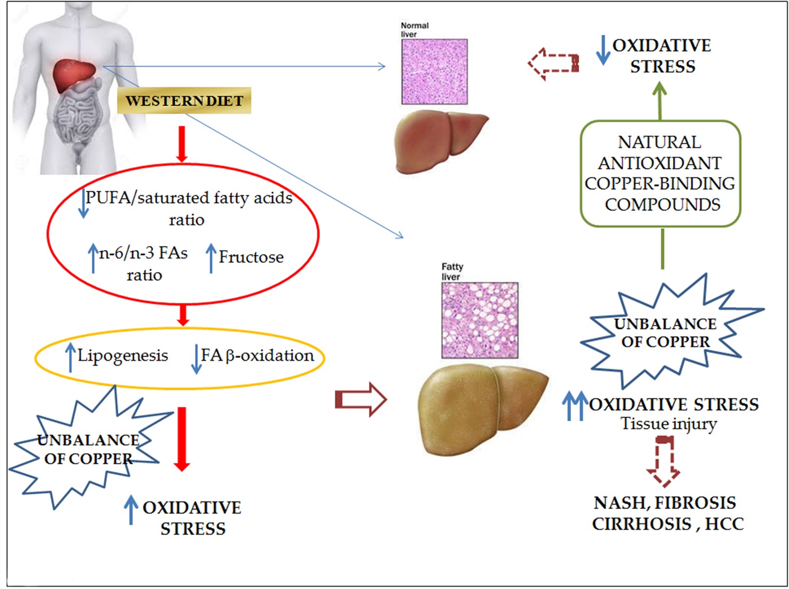 Summary of the main information on the onset and progression of NAFLD linked to diet.