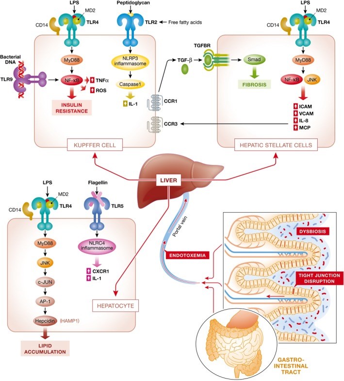 Pattern diagram featuring gut permeability, bacterial translocation, and TLR signaling in NAFLD/NASH.