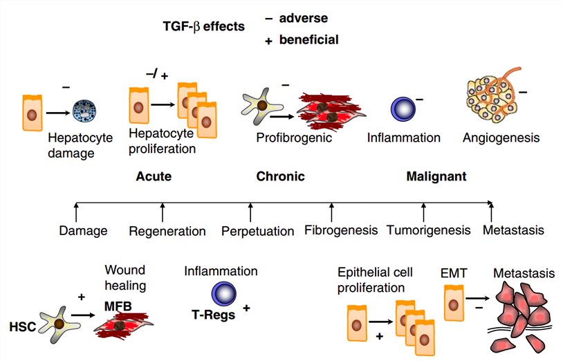 Pros and cons of TGF-β signaling during the progression of chronic liver diseases. 