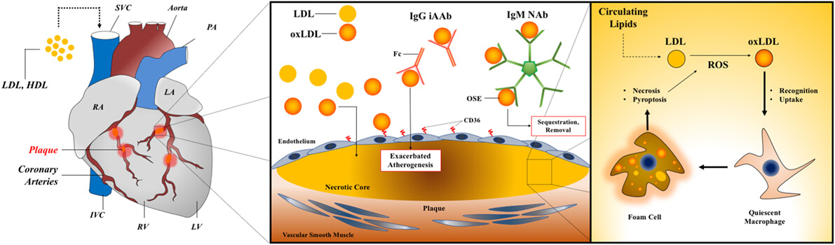 Autoantibodies in myocarditis and dilated cardiomyopathy.