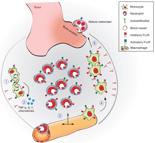 Fig.1 The inflammatory arthritis induced by autoantibody. (Ludwig, et al., 2017)