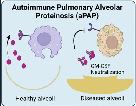 Fig.1 The aPAP development. (Lund-Palau, et al., 2022)