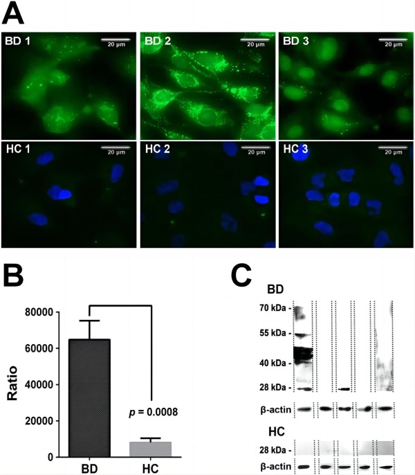 Autoantigen detection through indirect immunofluorescence assay. (Chen, et al., 2015)