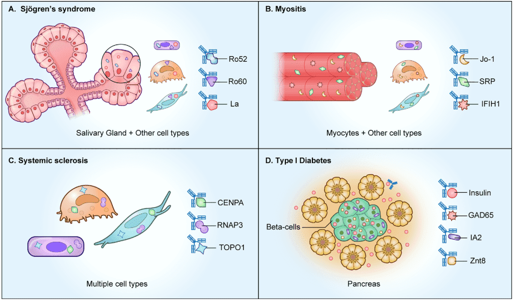 Fig.1 Autoantibodies to intracellular antigens. (Burbelo, et al., 2021)