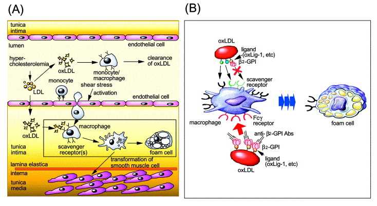 The general mechanism on atherosclerosis.